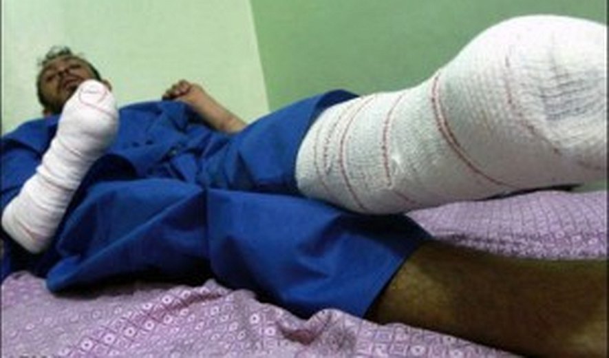 Another Amputation Sentence in Mashhad - Prisoner's Hand & Foot Cut Off 